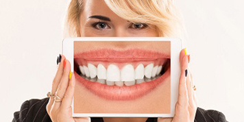 Antalya dental Veneer