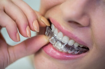Antalya Ortodontik (Diş Teli) Tedavileri